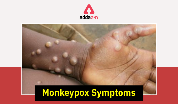 monkeypox