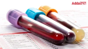 SGPT Full Form, Know About Its Meaning, Significance, Features and Benefits