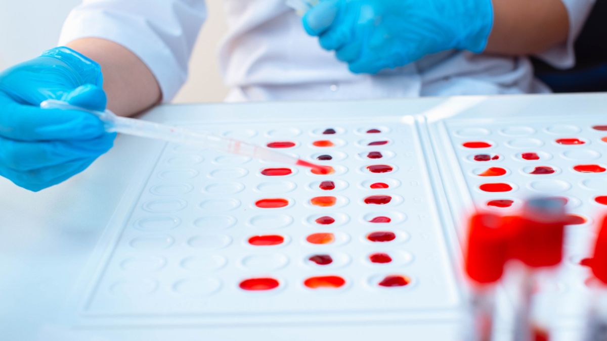 India Discovers World’s Rarest Blood Group ‘CRIB’