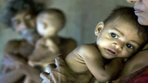 Data Shows 34% Children Under Five Are Stunted: India’s Malnutrition Burden Explained