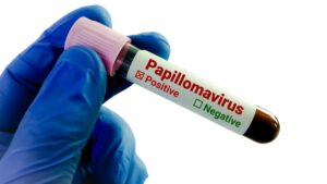 Indigenous HPV Test Validated by AIIMS and ICMR