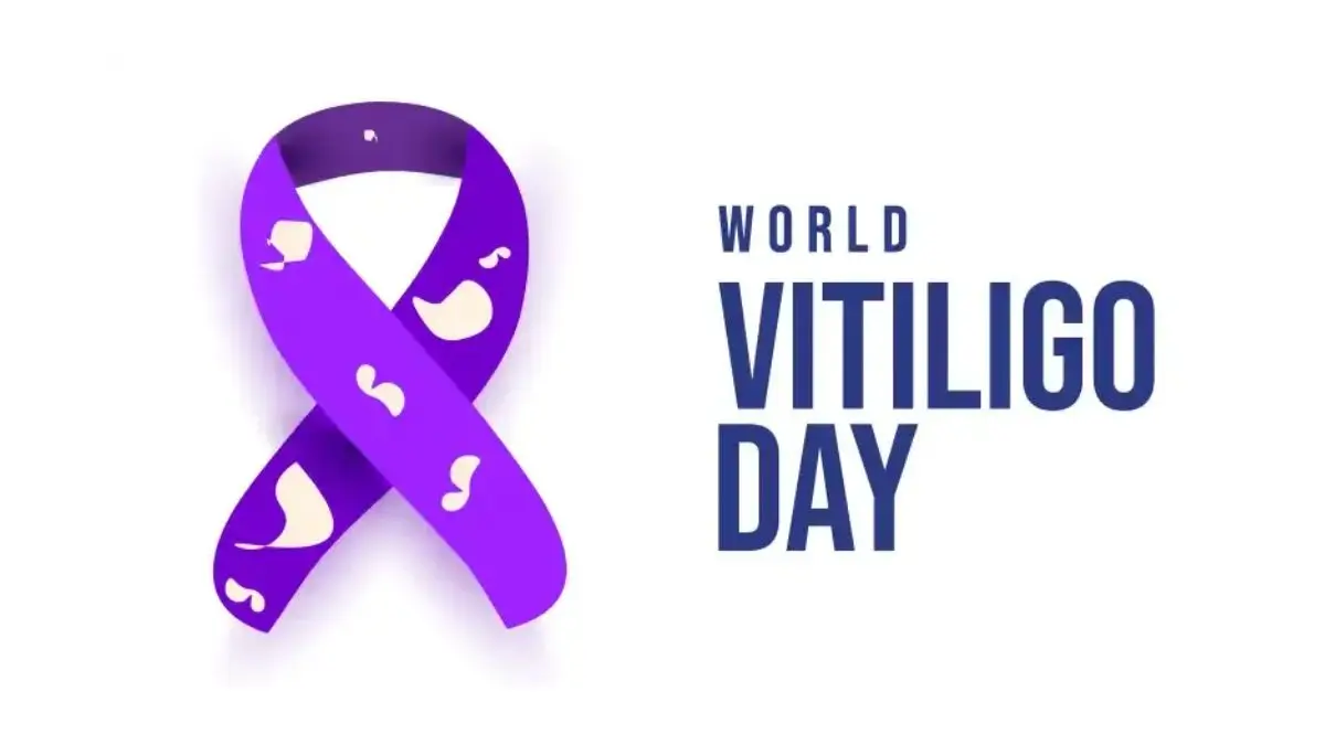 World Vitiligo Day 2026: Theme, Significance, Awareness and Ayurvedic Approaches to Skin Health